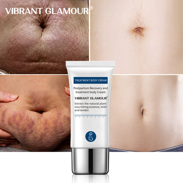 VIBRANT GLAMOUR Crocodile Stretch Marks Remover Cream