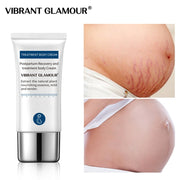 VIBRANT GLAMOUR Crocodile Stretch Marks Remover Cream