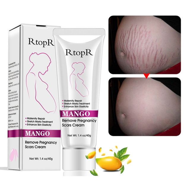 Mango Stretch Mark Cream For Pregnancy Repair